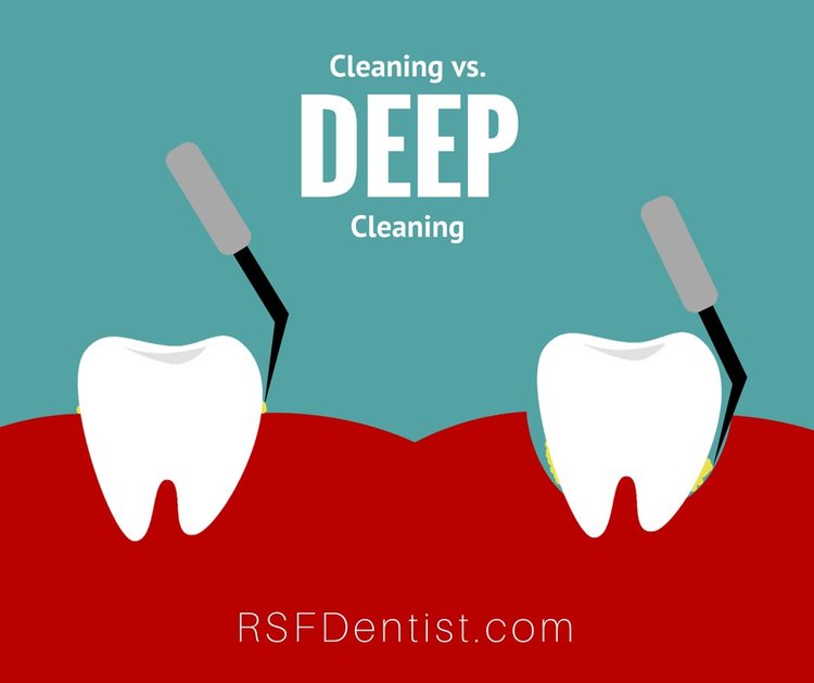 What Does Deep Clean Mean?