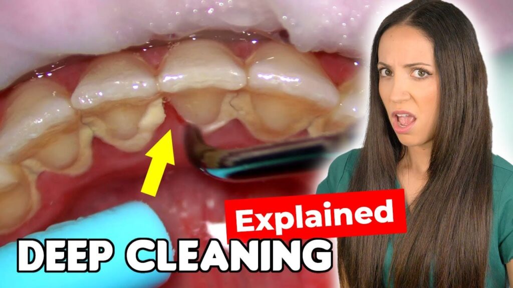 How Long Does A Deep Cleaning Take?