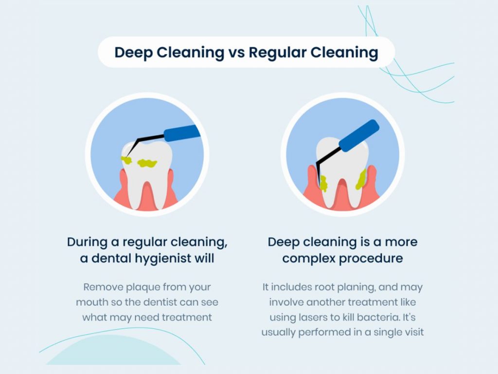 Whats The Difference Between Deep Cleaning And Regular Cleaning?